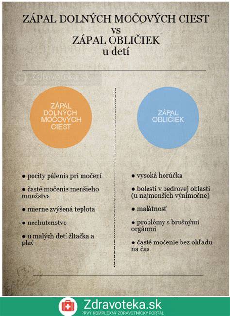Infografika anatomie obličiek a močových ciest