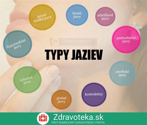 Infografika: Prehľad typov kožných výrastkov a ich charakteristík