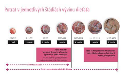 Zákon o práve na potrat na Slovensku: prehľad informácií a historický vývoj