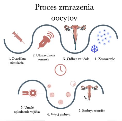 Infografika: Schéma procesu IVF od stimulačného protokolu po embryotransfer