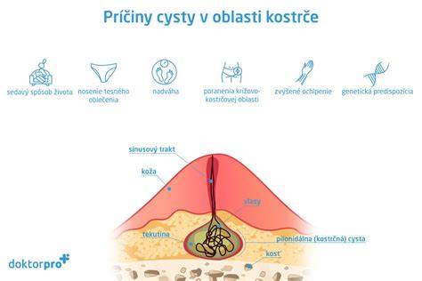 Otehotnenie po operácii cysty v prsníku: čo treba vedieť a ako postupovať