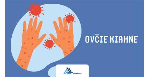 Diagrama infekčnosti počas priebehu ovčích kiahní