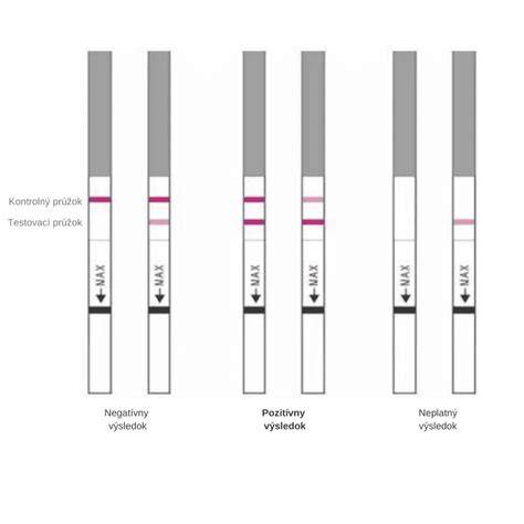 Infografika: Princíp ovulačného testu z moču vs. mikroskop zo slín