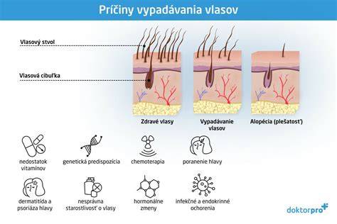 Infografika: Životný cyklus vlasov a hlavné príčiny vypadávania u detí