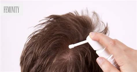 Vypadávanie vlasov po IVF stimulácii: príčiny a liečba