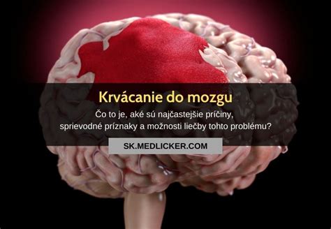 Masívne krvácanie po potrate: Príčiny, príznaky a liečba