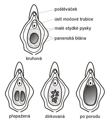 Panenská blana a riziko otehotnenia: vedecké fakty a mýty v súčasnom pohľade