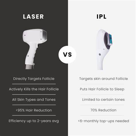 Infografika: Ako funguje IPL epilácia a porovnanie IPL vs Laser