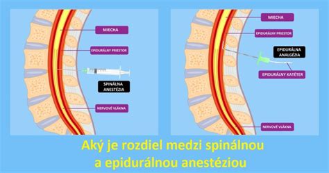 Infografika: Porovnanie staršej pôrodnice a monobloku v Prešove (počet boxov, prítomnosť sprievodnej osoby, epidurálna analgézia)