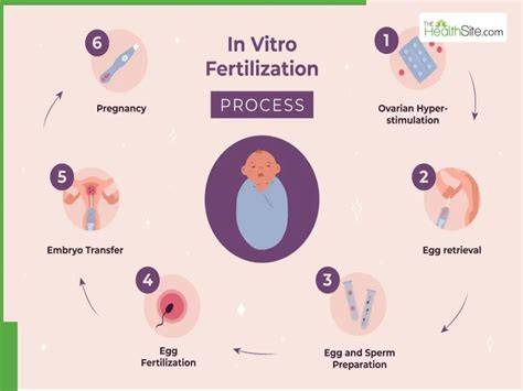 Infografika: Krok za krokom IVF cyklus - stimulácia, odber vajíčok, oplodnenie, kultivácia, transfer embryo, tehotenský test