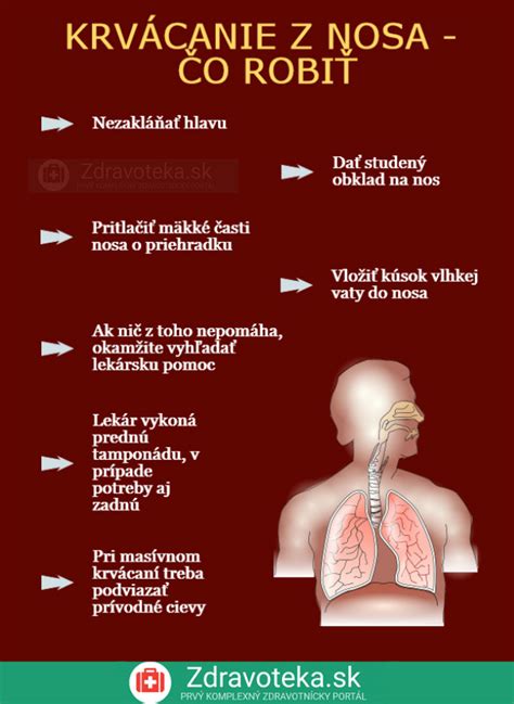 Infografika: Základné kroky prvej pomoci pri krvácaní z nosa u dieťaťa