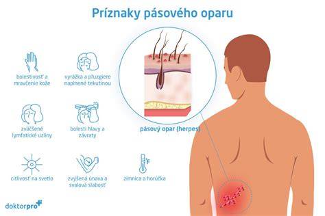 Mapa výskytu pásového oparu a jeho priebeh na pokožke