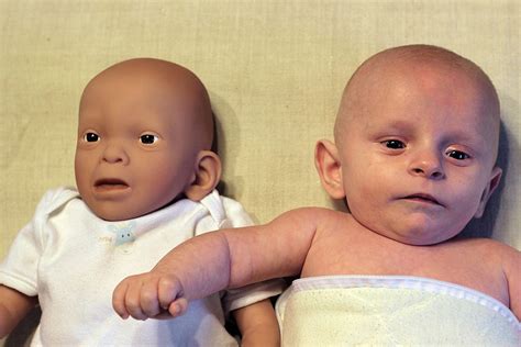 Deti s FASD a ich vývojové problémy