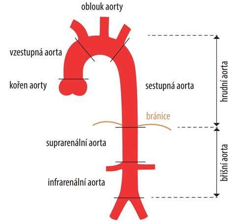 Infografika: Aorta a jej časti, rozdelenie na koreň, oblúk aorty a zostupnú aortu