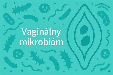 Infografika: Vaginálna mikroflóra a príčiny svrbenia