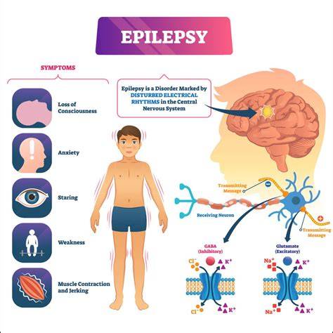 Epilepsia a ketóza: terapeutický pôvod diéty