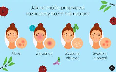 Infografika: Mechanizmy starnutia pokožky a ROS