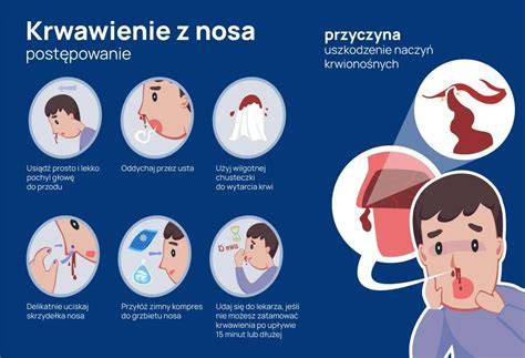 Infografika: Správny postup preplachu nosa u dojčaťa (krok za krokom)