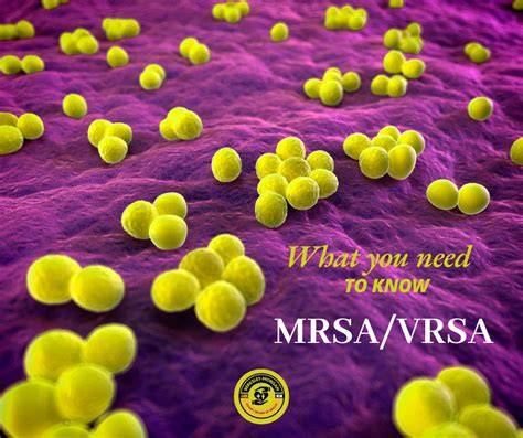 MRSA a VRSA - rezistentné kmene stafylokoka