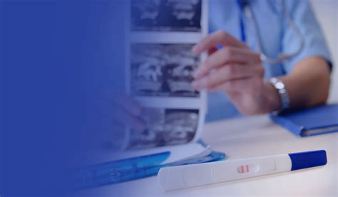 Vizualizácia rizík aneuploidie s vekom matky a postupov prenatálnej diagnostiky