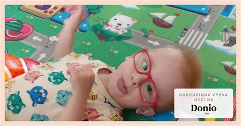 Ilustrácia mozgu s označenými oblasťami postihnutými detskou mozgovou obrnou