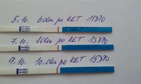 Infografika: Cezkrokový prehľad času na test po IVF
