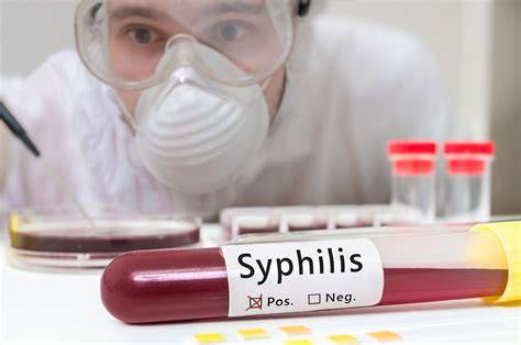 Syfilis: prenos, príznaky a liečba