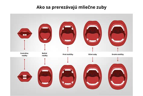 Obrázok znázorňujúci vývoj mliečnych a trvalých zubov a dopad na miesto pre trvalý zub