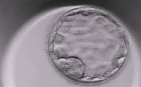Schéma IVF protokolu a načasovania transferu embrya