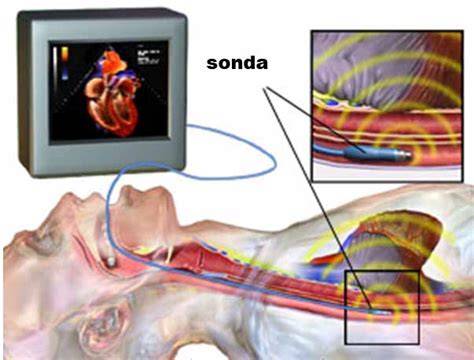 Echokardiografia srdca: princípy a klinické využitie