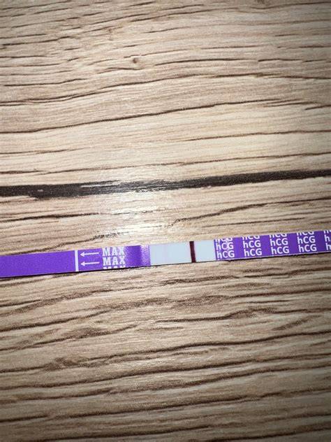 Infografika: kroky IVF od konzultácie po tehotenský test