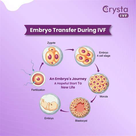 Infografika: Princíp IVF a embryotransfer