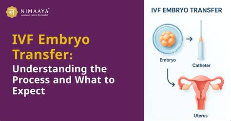 Schéma IVF procesu: stimulácia, odber vajíčok, IVF, transfer embryo
