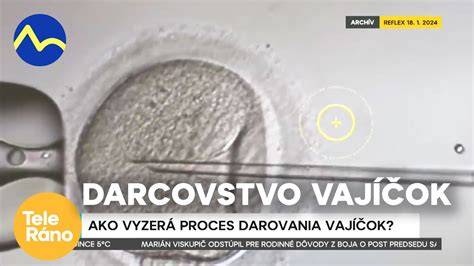 Infografika: Registrovanie pôvodu dieťaťa a proces darovania vajíčok