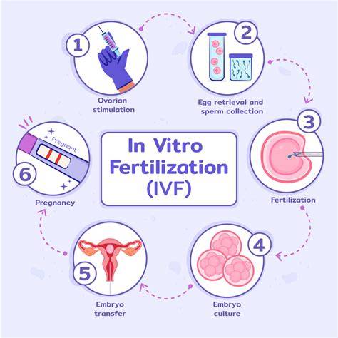 Infografika: proces IVF od stimulácie vaječníkov po implantáciu embrya