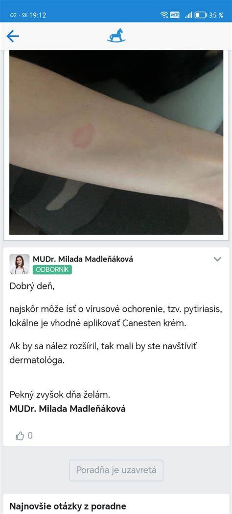 Infografika: Čo spôsobuje červené fľaky na koži u detí