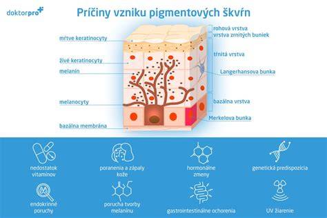 Infografika: Hlavné príčiny červených škvŕn na tvári u detí a čo robiť pri každej z nich