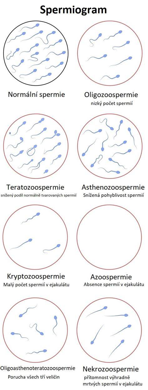 Vizualizácia vplyvu antibiotík na spermiogram (schéma: cyklus spermií, oneskorené účinky antibiotík, časové okno 6-8 týždňov)