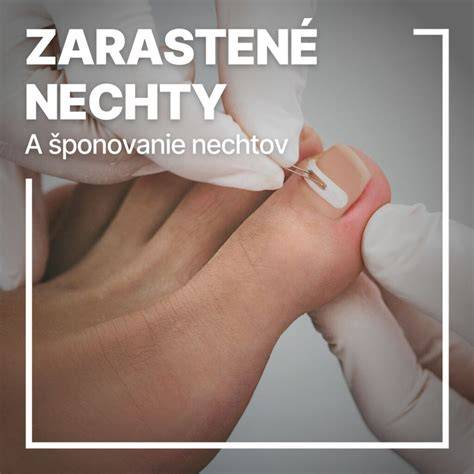 Ilustrácia bezpečných nechtových strihačov a správneho strihania