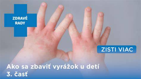 Infografika o diagnostike vyrážok u detí