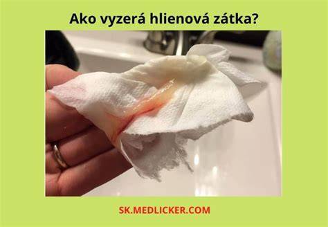 Infografika: Signály blížiaceho sa pôrodu - klesnutie brucha, hlienová zátka, odtok vody, kontrakcie
