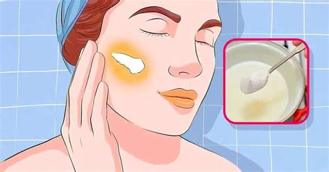 Ilustrácia tehotenskej masky na tvári