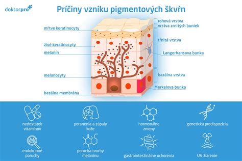 Pigmentové škvrny po narodení: Príčiny, prejavy a možnosti riešenia