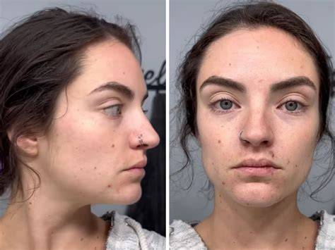 Žena zverejnila fotky dieťaťa v 14. týždni po potrate a príbehy žien po strate dieťaťa