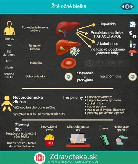 Infografika: Zobrazenie príčin, príznakov a liečby anémie u dojčiat