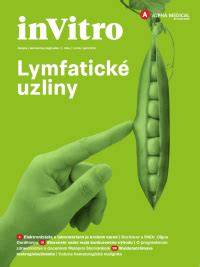 Infografika o lymfatickom systéme a uzlinách