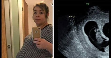 Ultrazvukový snímok vaječníka