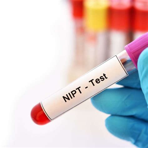 Porovnanie NIPT testov