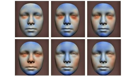 Porovnanie tváre dieťaťa matky, ktorá pila alkohol v tehotenstve, a matky, ktorá nepila