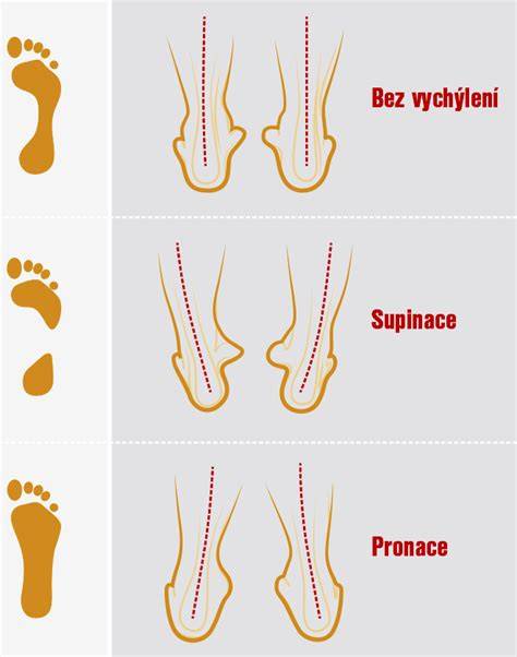 Infografika: Správny výber obuvi a doplnkov na tehotenstvo